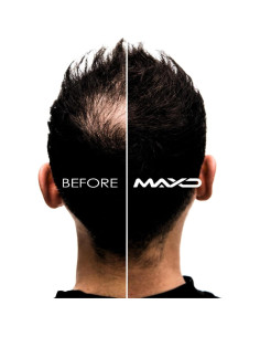 Kit de Engrosamiento de Cabello MAXD - Fibras, Spray y Aplicador 2