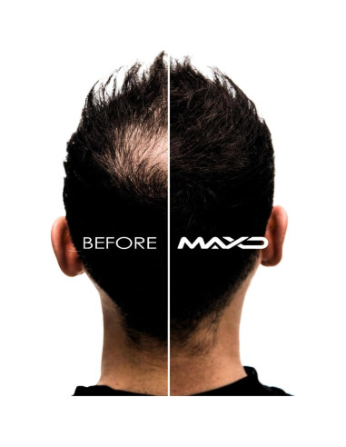 Kit de Engrosamiento de Cabello MAXD - Fibras, Spray y Aplicador