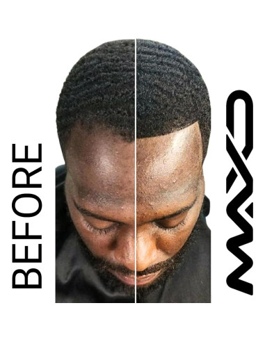 Kit de Engrosamiento de Cabello MAXD - Fibras, Spray y Aplicador