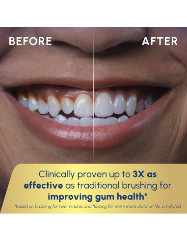 Irrigador Bucal y Cepillo Eléctrico Waterpik Sensonic CC-04