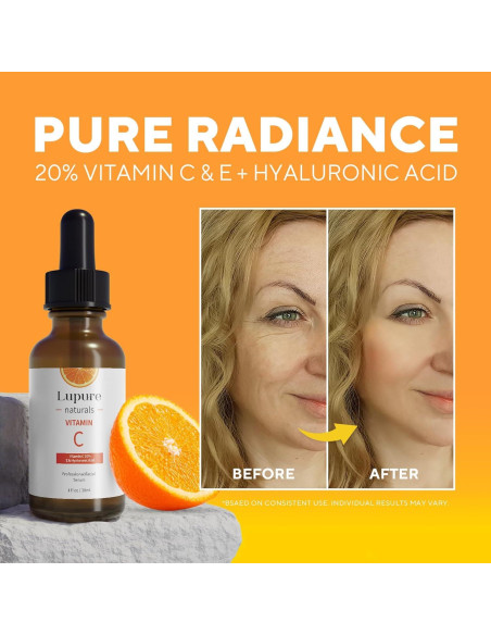 Suero Facial Antienvejecimiento Lupure 29.57 ml Vitamina C