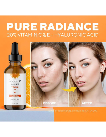 Suero Facial Antienvejecimiento Lupure 29.57 ml Vitamina C