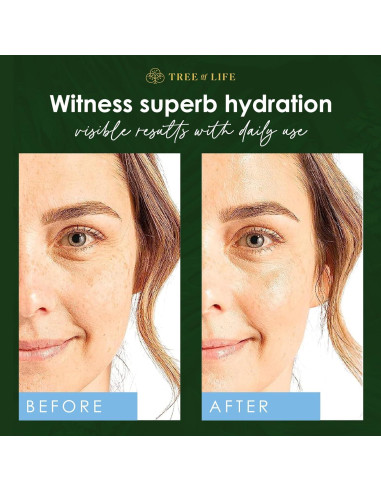 Suero de Ácido Hialurónico Tree of Life 59 ml - Hidratante Facial