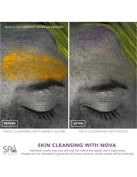 Cepillo de limpieza facial Spa Sciences NOVA - Exfoliante USB