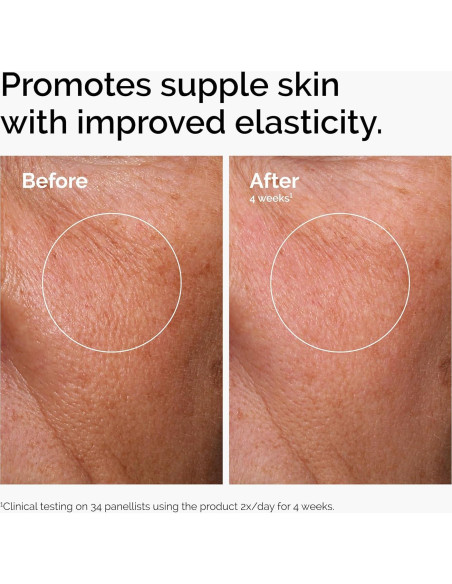 Trío de Sérums Hidratantes The Ordinary - Ácido Hialurónico, Niacinamida y Cafeína Trío de Sérums Hidratantes The Ordinary - Ácido Hialurónico, Niacinamida y Cafeína