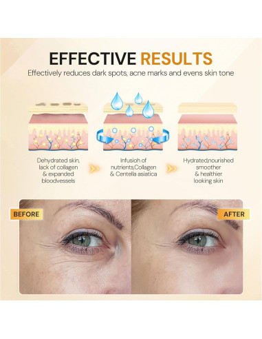 Parches para Ojos KUTDEP Dorado 10 Pares Hidratantes