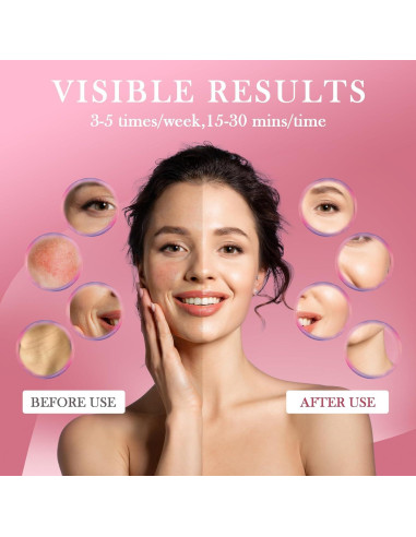 Máscara de Terapia de Luz Roja VIVIDCHARM LED Inalámbrica