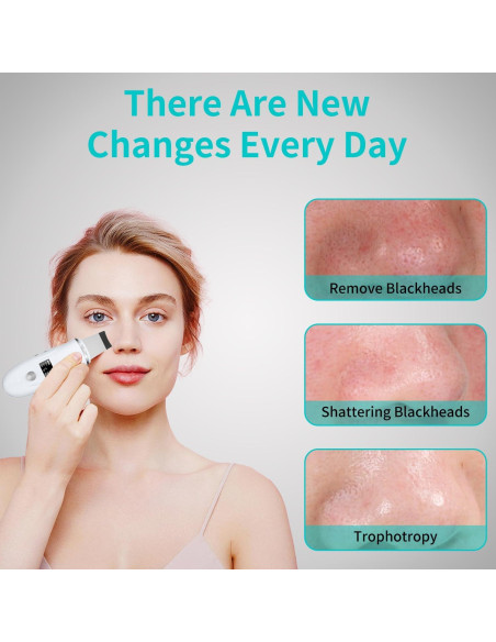 Espátula Facial QYCSL 4 en 1 - Limpieza Profunda y Exfoliación