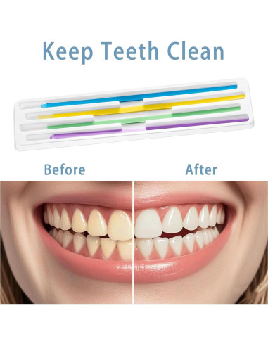 Kit de Tiras de Pulido Dental DANTICY 80 Piezas 15.24 cm