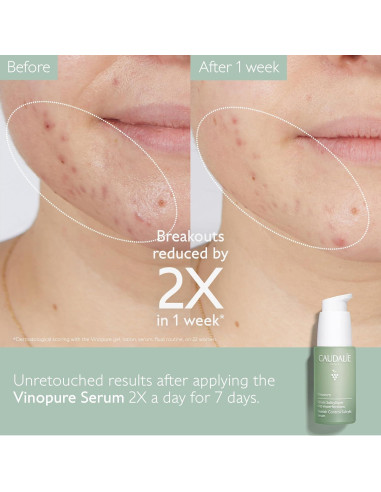 Suero Natural Caudalie Vinopure Ácido Salicílico 30 mL