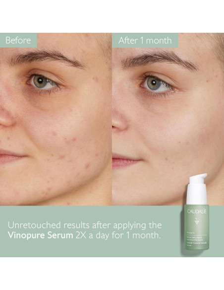 Suero Natural Caudalie Vinopure Ácido Salicílico 30 mL