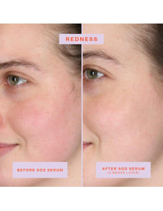 Suero Intensivo SOS Tower 28 para Piel Sensible 59 ML 2