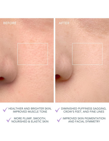 Cepillo Limpiador Facial Foreo LUNA 4 - Masajeador Reafirmante