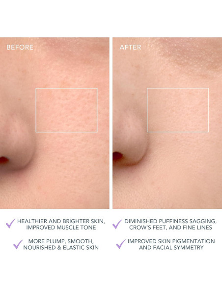 Cepillo Limpiador Facial Foreo LUNA 4 - Masajeador Reafirmante