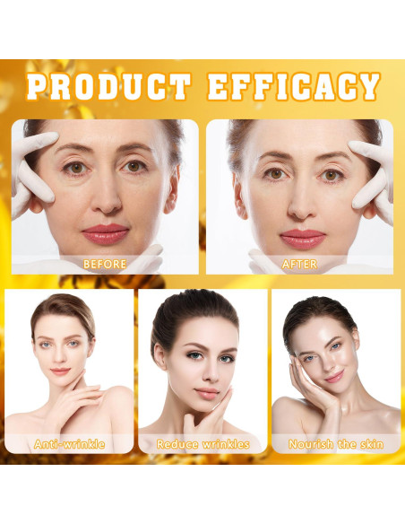 Crema de Piel de Veneno de Abeja Retinol YIVANNUO 191g