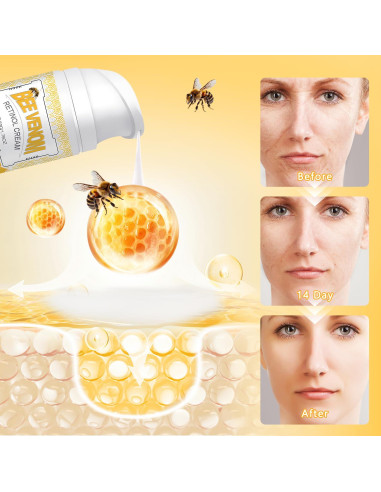 Crema de Piel de Veneno de Abeja Retinol YIVANNUO 191g