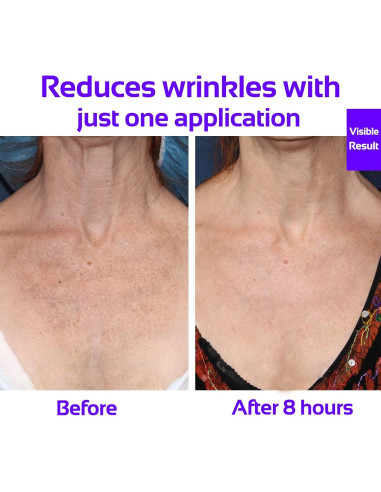 Parche Antarrugas para el Pecho Skywee - Set de 3 Parches de Silicona Reutilizables