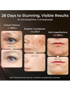 Máscara de Terapia de Luz Roja LED ONLUKY 3 Niveles 2500mAh 2