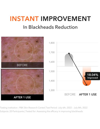 Bálsamo Limpiador APRILSKIN Carrotene 90 ml Piel Sensible