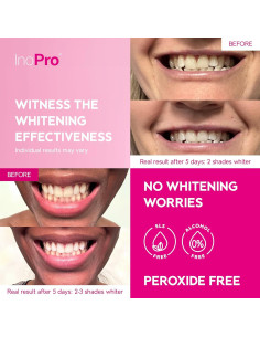 Kit 14 Tiras Blanqueadoras Dientes Smile&Shine Sin Peróxido 2