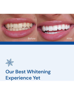 Kit Blanqueamiento Dental SNOW - Suero y Boquilla LED 2