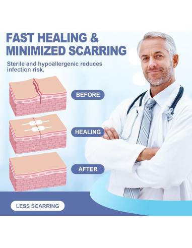 Kit de Cierre de Heridas AID MATE 6 Piezas Sin Suturas