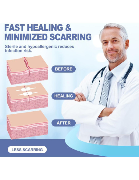 Kit de Cierre de Heridas AID MATE 6 Piezas Sin Suturas