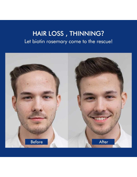 Champú Engrosante Ceson&Cesun 300ml con Romero y Biotina