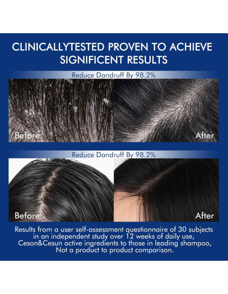 Champú Engrosante Ceson&Cesun 300ml con Romero y Biotina