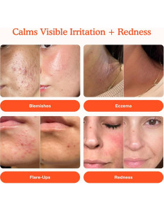 Protector Solar Tinte SPF 30 Tower 28 + Spray Facial SOS 118ml 2