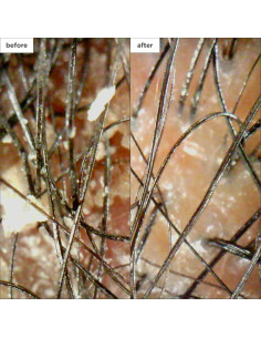 Kit Detoxificante Cuero Cabelludo Briogeo Soothe - 4 Piezas 2