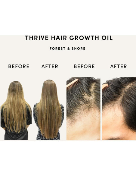 Aceite para Crecimiento del Cabello Forest & Shore 100ml