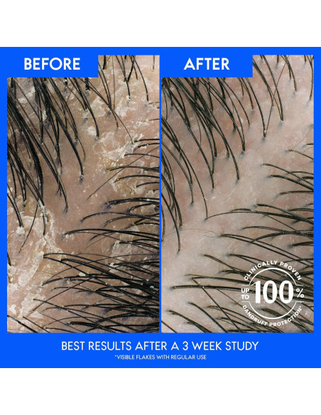 Champú Anticaspa Head & Shoulders 950 ml Doble Aceite Almendra Champú Anticaspa Head & Shoulders 950 ml Doble Aceite Almendra