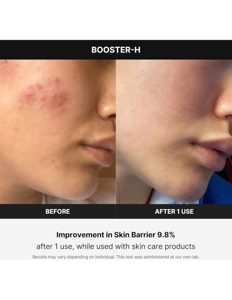 Medicube Age-R Booster H - Acelerador de Brillo Facial