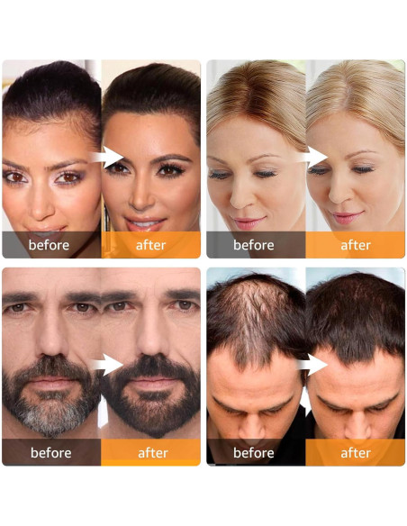 Cobertura Instantánea Raíces Cabello Canoso Polvo ABOMET 3.98g Marrón Medio