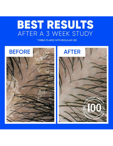 Head & Shoulders 2-en-1 Champú y Acondicionador Limpieza Clásica 2L