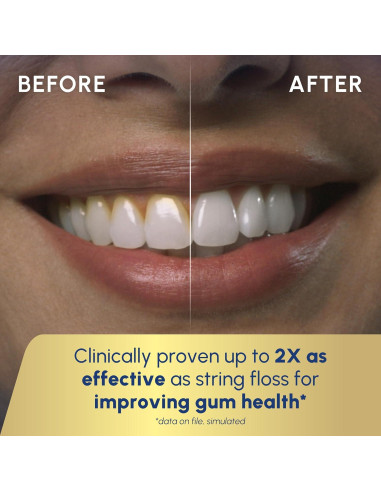 Hilo Dental Inalámbrico Waterpik WP-580 Blanco Recargable