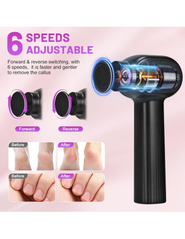 Removedor de Callos Eléctrico Recargable FVNANL 2 en 1