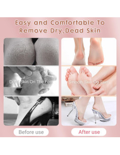 Removedor de Callos Eléctrico Seyoagain con 60 Discos de Lija 2