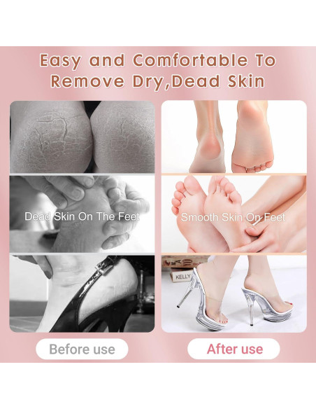 Removedor de Callos Eléctrico Seyoagain con 60 Discos de Lija