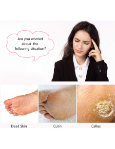 Kit de Pedicura 4 en 1 Fangze - Cepillo y Piedra Pómez 2