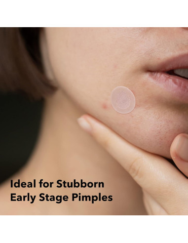 Parches Microneedle Avarelle Spot Tech para Acné 18 CT