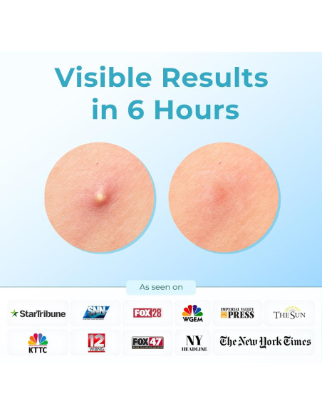 Parche Hidrocoloide para Acné CLEOF - 46 Unidades Vegano