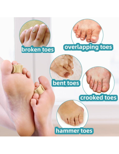 Separadores de Dedos Reutilizables Meidland Beige para Alineación