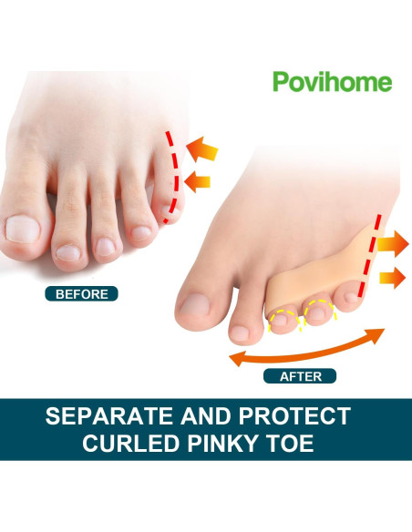 Separadores de Dedo Meñique Povihome 10 Paquetes Beige