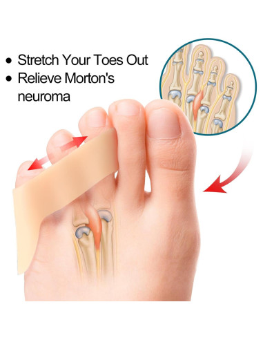 Separadores de Dedo Meñique Povihome 10 Paquetes Beige