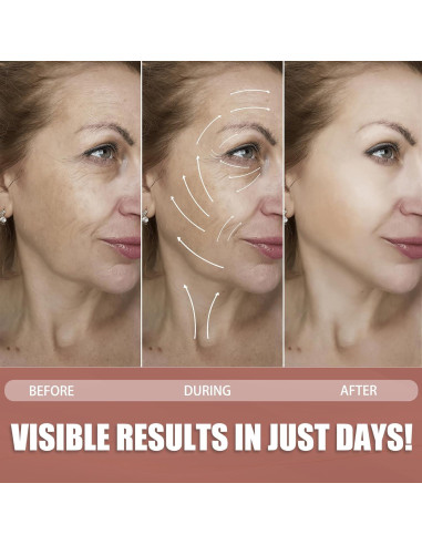 Cinta Facial Antienvejecimiento Akissos - 2 Rollos de 5m