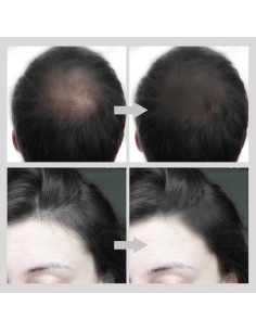 Barra de Polvo para Cabello Boobeen - Cubrimiento Canas y Raíces 2