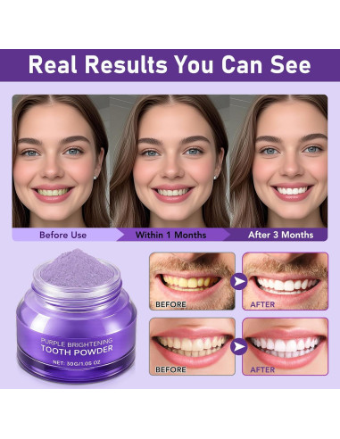 Polvo Blanqueador de Dientes WHLH - Aclarador Suave 29.57g