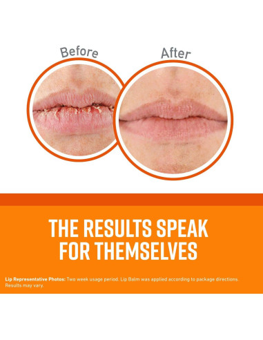 Bálsamo Labial O'Keeffe's Reparador Sin Fragancia 9g